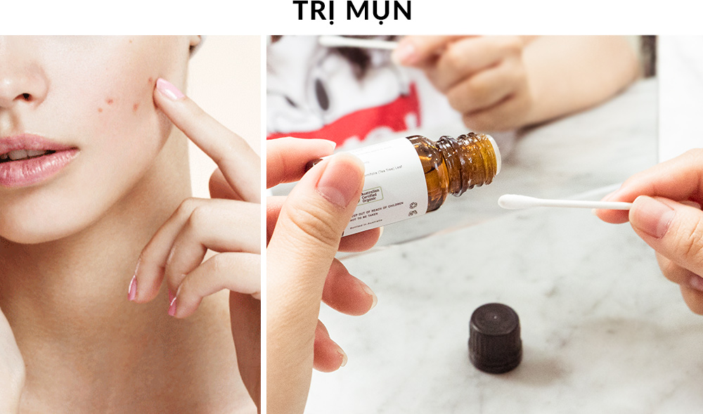 Đáng chú ý trong bài viết, Kiara Tea Tree Oil là sản phẩm trị mụn hiệu quả, an toàn cho làn da nhạy cảm. Ẩn sau làn da mụn, sản phẩm được săn đón nhờ khả năng làm dịu và giảm mụn nhanh chóng.