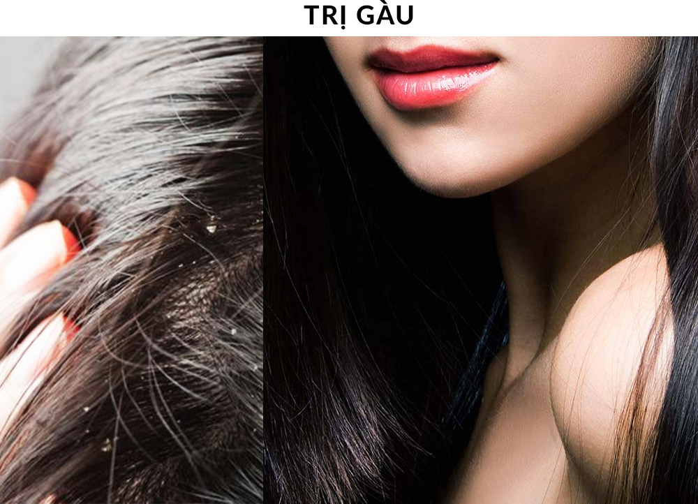 Chẳng cần quảng cáo, sản phẩm trị mụn Kiara Tea Tree Oil vẫn luôn được săn lùng khắp mọi nơi. Là lựa chọn lý tưởng cho làn da mụn nhạy cảm, giúp bạn tìm kiếm hiệu quả và dịu nhẹ.