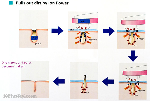 Hình ảnh mô tả quy trình làm sạch da bằng công nghệ ion, cho thấy cách mà bụi bẩn được loại bỏ khỏi lỗ chân lông, là giải pháp hữu hiệu cho làn da sáng khỏe hơn với sự kết hợp của Vitamin C.