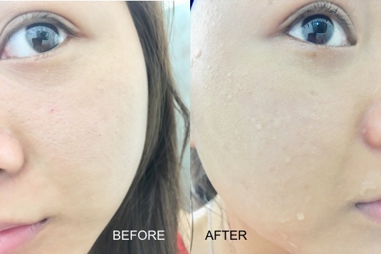 Hình ảnh so sánh làn da trước và sau khi sử dụng bộ sản phẩm dưỡng ẩm Huxley Hydration Duo trong 30 ngày, nhấn mạnh sự khác biệt rõ rệt và hiệu quả của chu trình dưỡng da cho da khô.