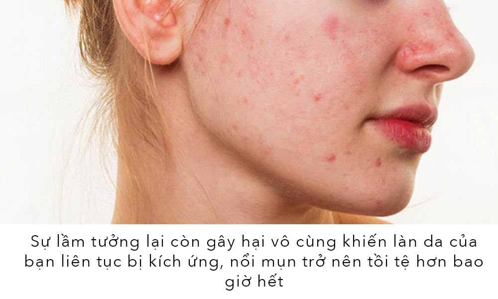 Sự lầm tưởng về da dầu khiến bạn khó khăn trong việc lựa chọn sản phẩm dưỡng da phù hợp. Để có làn da đẹp như gái Hàn và khắc phục tình trạng bóng dầu ở vùng chữ T, nên áp dụng các bước dưỡng da thực sự hiệu quả.