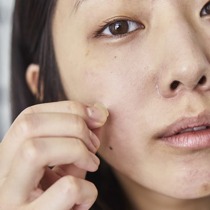 Chia sẻ bí quyết chiến đấu với da mụn thông qua 3 sản phẩm mỹ phẩm trị mụn hiệu quả, giúp bạn có làn da sạch mụn nhanh chóng trong bài viết này.