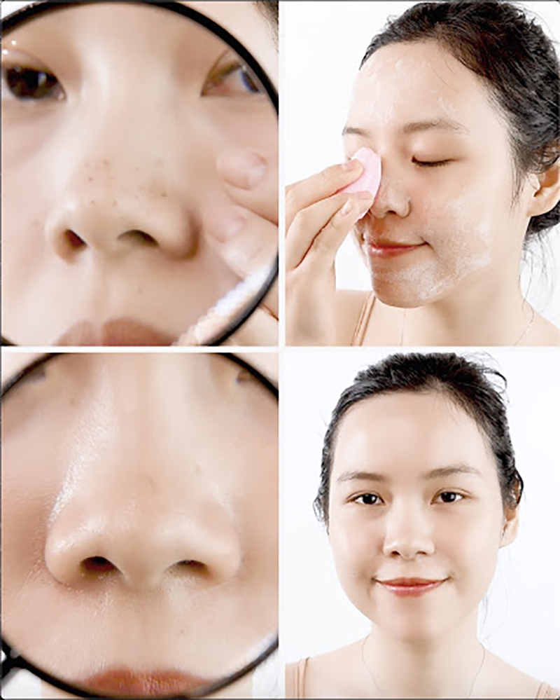 Bài viết hướng dẫn 5 bước dưỡng da cơ bản cho người mới bắt đầu, giúp các cô nàng "gà mờ" trong việc chăm sóc da. Hãy tìm hiểu các bước skincare đơn giản để có làn da khỏe đẹp.