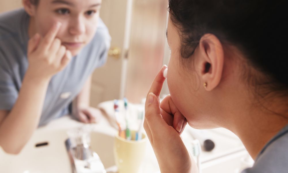 Chăm sóc da mụn và làm giảm thâm hiệu quả với routine 5 bước đơn giản. Thực hiện chuẩn các bước chăm sóc da cơ bản để sở hữu làn da khỏe mạnh.