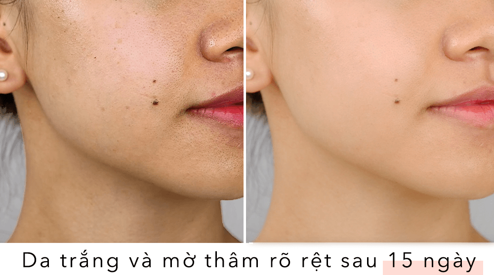Trái với suy nghĩ, chỉ 30% serum thẩm thấu vào da, dẫn đến hiệu quả skincare không như mong đợi. Halio Ion là máy đẩy tinh chất dưỡng trắng, giúp tăng cường hấp thu dưỡng chất. Khám phá 5 lý do nên đầu tư vào Halio Ion để sở hữu làn da mịn mướt, sáng khỏe.