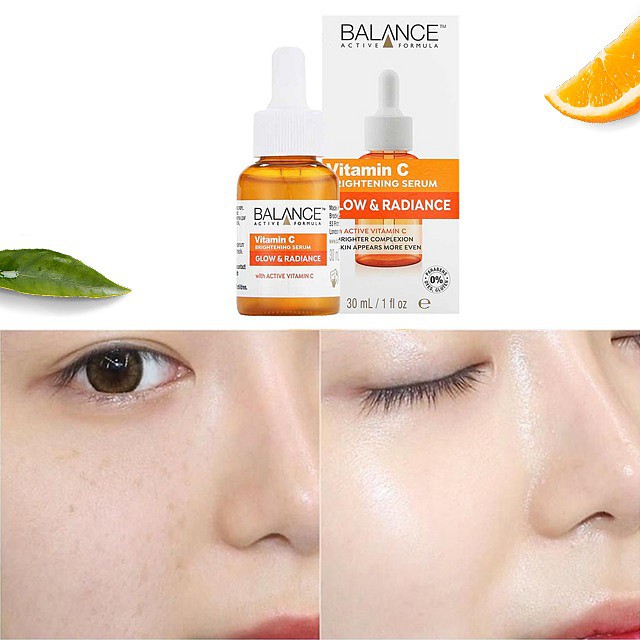Serum làm sáng da Vitamin C Balance là một sản phẩm skincare nổi bật trong dịp nghỉ dịch, giúp nâng tông da trắng mịn và phục hồi các vấn đề về da như nám sạm, đem lại vẻ ngoài rạng rỡ, đầy sức sống.