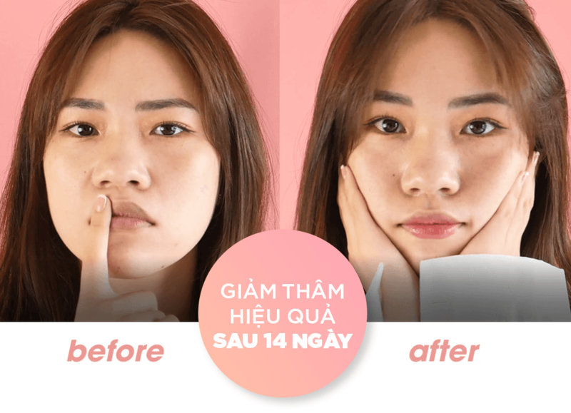 Hình ảnh so sánh trước và sau khi sử dụng sản phẩm chăm sóc môi, thể hiện sự khác biệt đáng kể về độ căng bóng và quyến rũ của đôi môi theo bí quyết Pony. Khám phá cách dưỡng môi với son dưỡng và lustre lip balm để có kết quả tốt nhất.