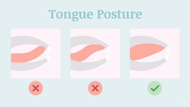 Hướng dẫn tư thế lưỡi đúng giúp tạo hình khuôn mặt đẹp hơn, cập nhật xu hướng làm đẹp #Mewing đang gây bão trên Tiktok, với thao tác đơn giản làm nọng cằm biến mất trong một giây.