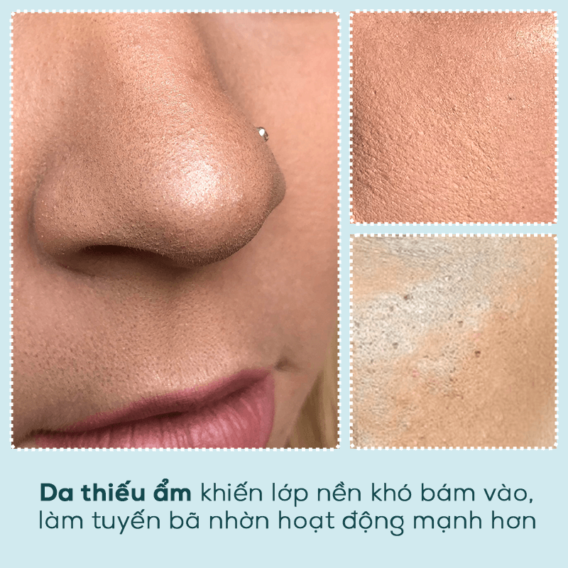 Da thiếu ẩm khiến lớp nền khó bám vào, làm tuyến bã nhờn hoạt động mạnh hơn. Tìm hiểu bí kíp dưỡng ẩm trước khi makeup để có lớp nền hoàn hảo.