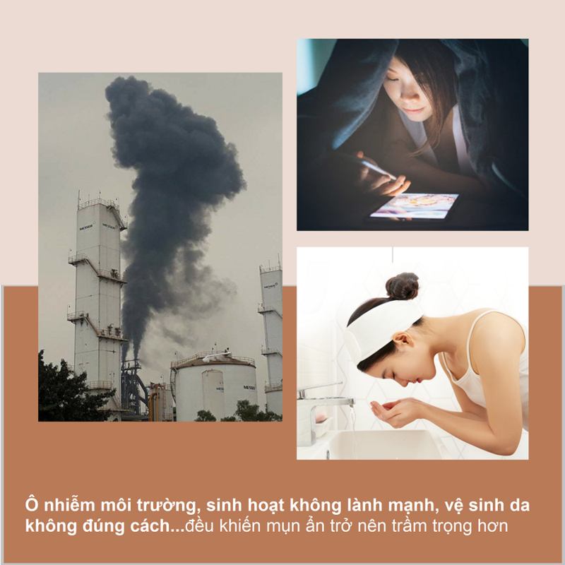 Mụn ẩn khiến da sần sùi và không ăn phấn. Ô nhiễm môi trường và sinh hoạt không lành mạnh làm tình trạng mụn trở nên tồi tệ hơn. Tìm hiểu về cách ngăn ngừa mụn dưới da hiệu quả.