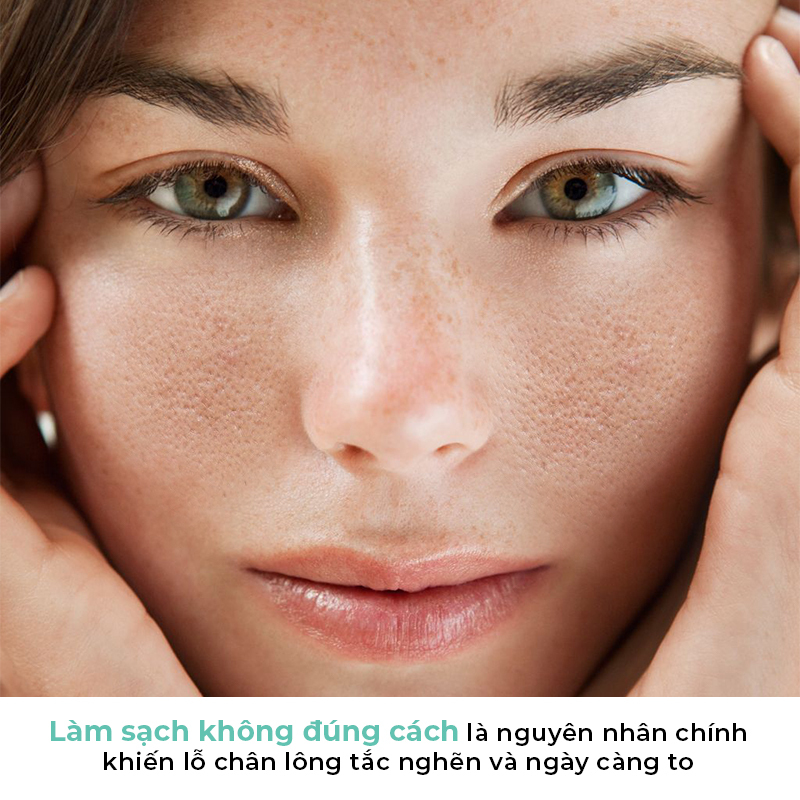 Bí quyết giúp cải thiện tình trạng lỗ chân lông to cho da dầu, liên quan đến việc làm sạch da đúng cách. Thời tiết hè tại Việt Nam khiến lỗ chân lông nở to, bài viết hướng dẫn cách khắc phục hiệu quả để có làn da mịn màng hơn.