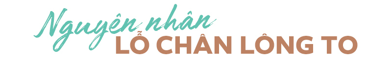 Nguyên nhân lỗ chân lông to và cách khắc phục lỗ chân lông to. Làn da dầu có thể làm lỗ chân lông to hơn, ảnh hưởng đến sự tự tin. Khám phá bí quyết làm sạch hiệu quả để cải thiện tình trạng này.