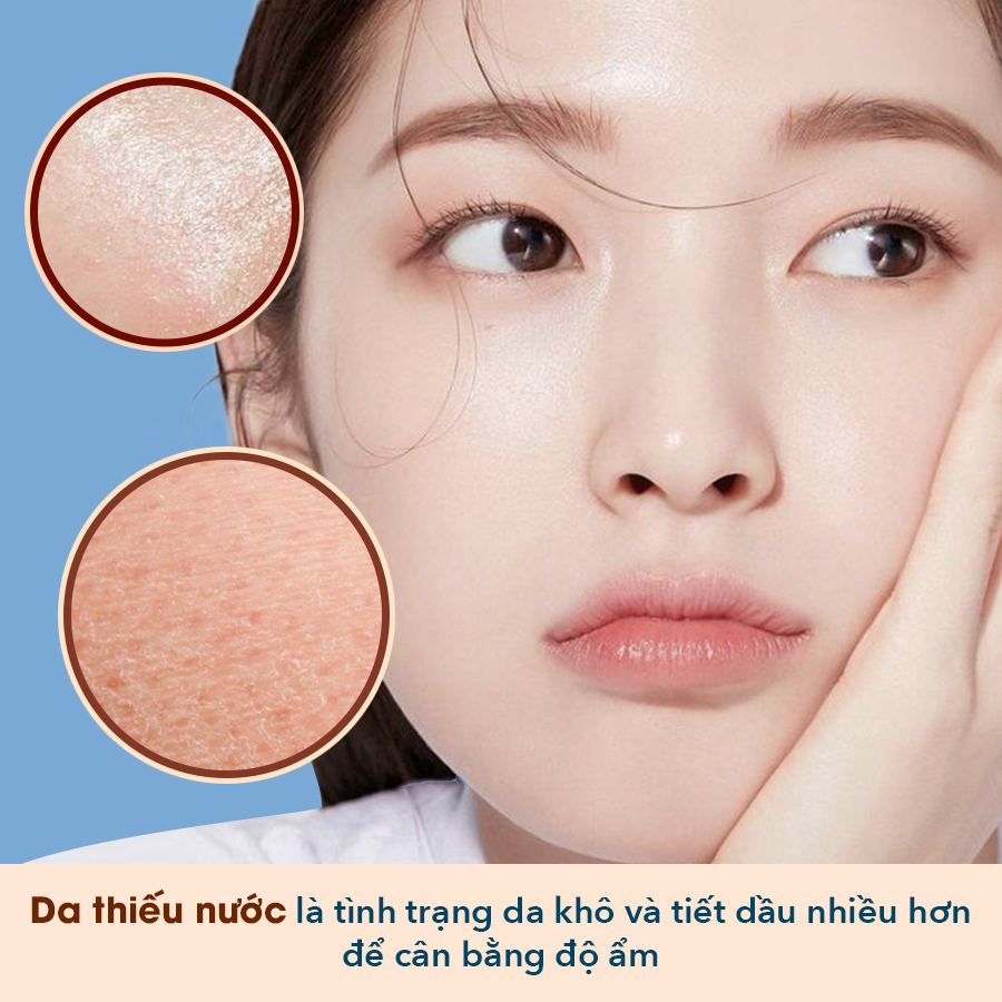 Cấp nước cho da để khắc phục tình trạng da thiếu nước, dấu hiệu da khô và cách giữ ẩm hiệu quả. Nhiều phụ nữ không nhận ra da mình đang cần nước, ảnh hưởng đến sức khỏe làn da.