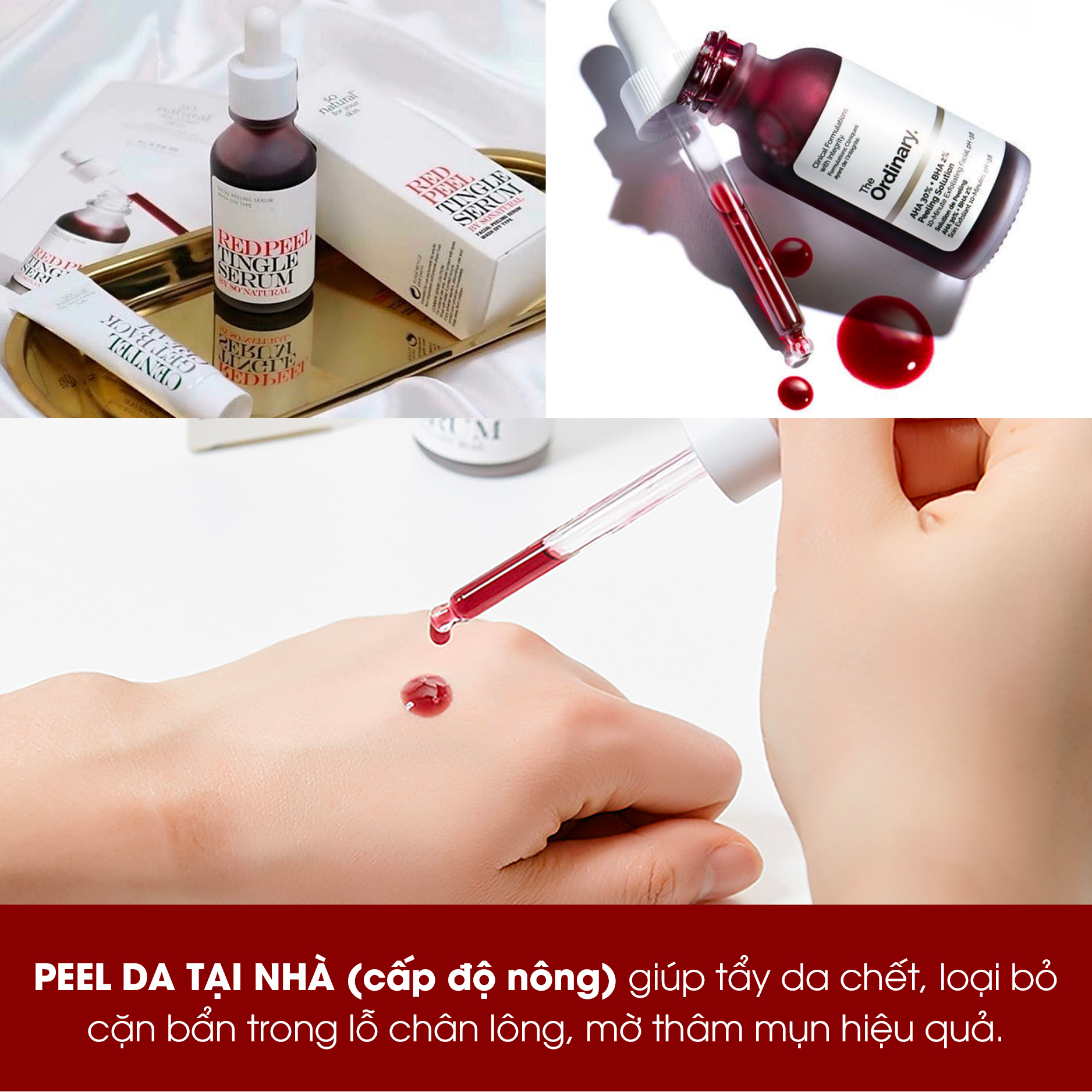 Peel da tại nhà: đừng bỏ qua 3 lưu ý sau nếu không muốn da bỏng rát, kích ứng mãi không lành. Trong những ngày giãn cách, mọi người thường tự peel da để khắc phục mụn, sạm nám và làm da trắng mịn hơn. Tuy nhiên, newbie dễ phạm phải 3 sai lầm khiến da kích ứng, bỏng rát.