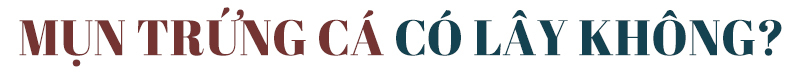 Câu hỏi về mụn trứng cá có lây không trở thành tâm điểm chú ý. Mụn trứng cá là ‘nỗi ám ảnh’ lớn, gây mất thẩm mỹ và thắc mắc từ nhiều chị em. Bài viết khám phá sự thật và giải đáp câu hỏi này.