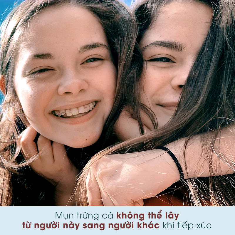 Mụn trứng cá không thể lây từ người này sang người khác khi tiếp xúc. Hãy cùng tìm hiểu thêm về mụn trứng cá và những cách trị mụn trứng cá hiệu quả!