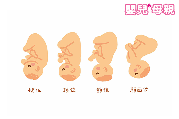快生了才發現胎位不正，如何自然產？ | 嬰兒與母親
