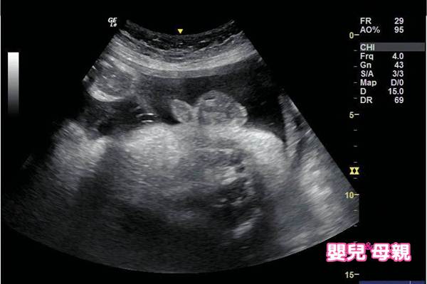 超音波解密 懷孕後期寶寶在肚子裡做什麼 嬰兒與母親