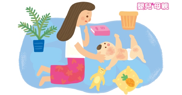 皮膚搔癢 反覆濕疹發作 如何照顧 異位性皮膚炎 的寶寶 嬰兒與母親