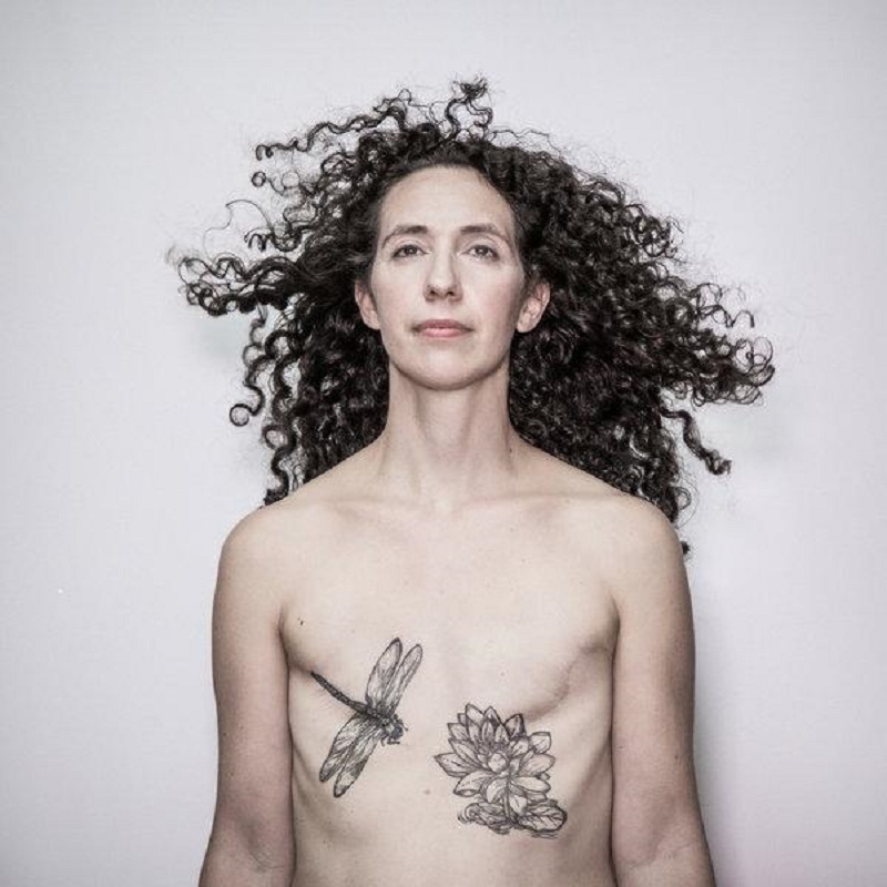 breast-cancer
