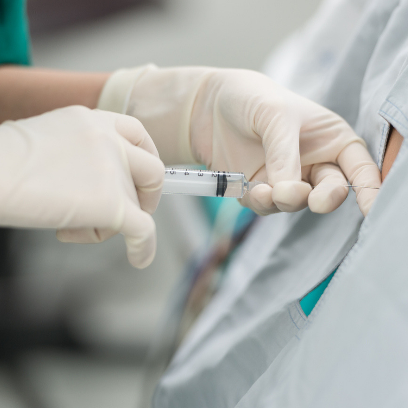epidural