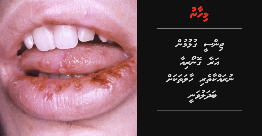 Jinsee gulhumun araa nurakkaatheri bayyeh beyhan nugudaa haalathakah