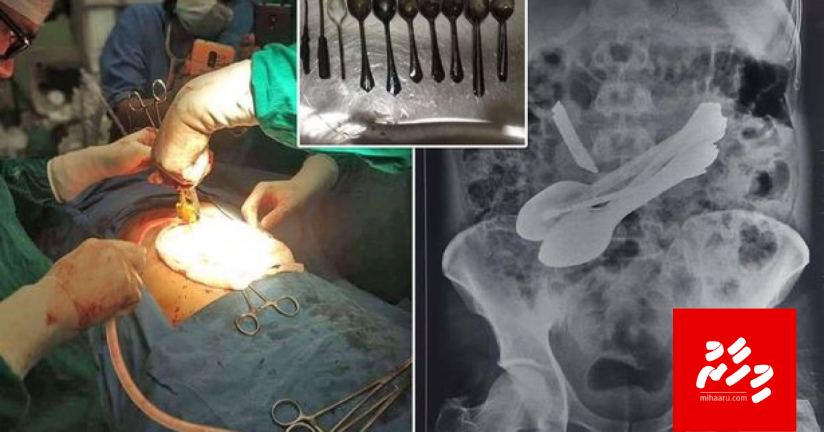 Meehegge bandun valhi aa samusalaa iskuru anburaa kashigandu thakeh nagaifi