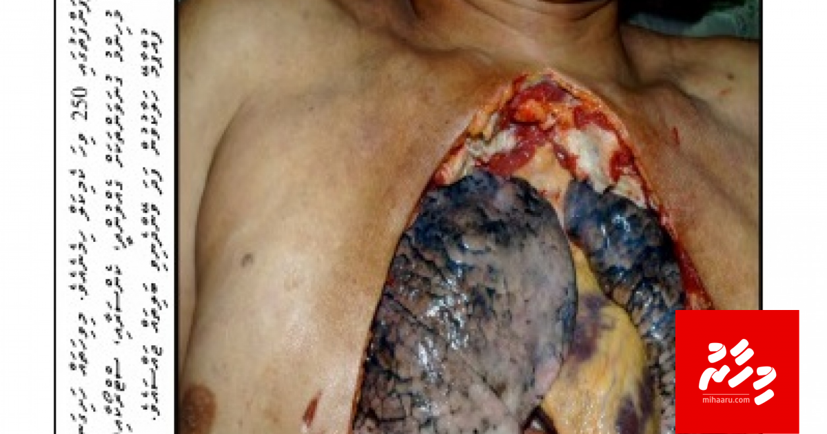 Inzaaru ge manzaru nujahai dhunfathuge baavaiythah ethere kurun manaa koffi