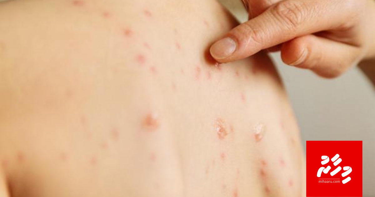 2 vana meehakah himabihi jehi ithuru meeheh ge test hadhanee