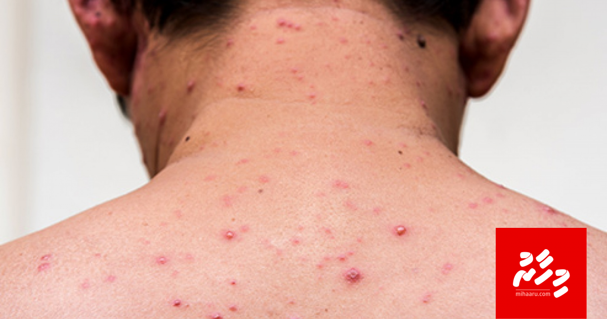 Himabiheege alaamaaithah