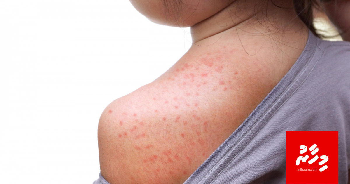 Dhelakka meehunnah dhevey varah, hima biheege vaccine hamajehijje