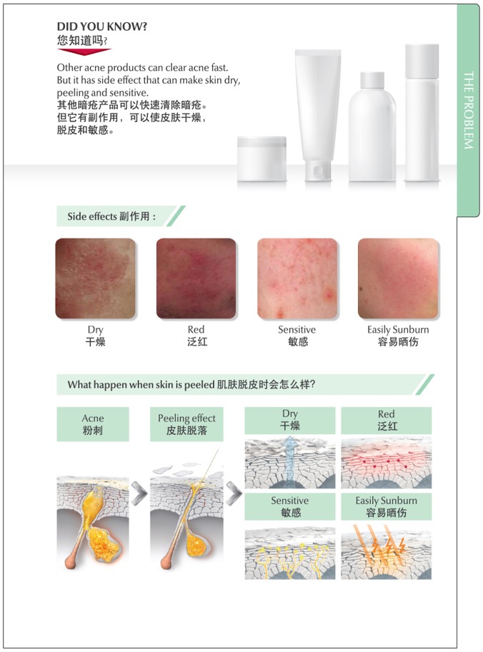 NEW - 8067-17_ProACNE 3D Sale Kit OL FA-02..jpg
