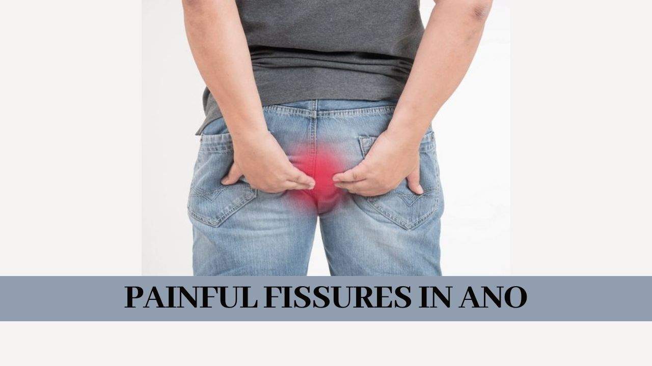 PAINFUL FISSURES IN ANO
