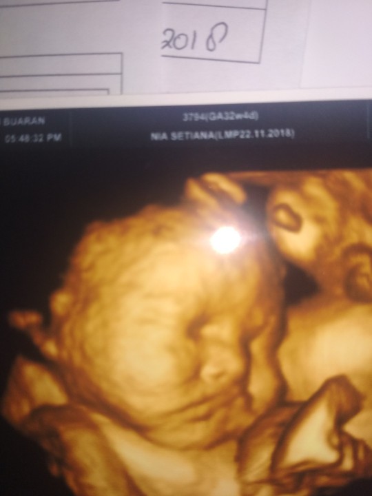 Usg 4d Yg Murah Dimana Apa Haibumil Kemayoran Murah Usg 4d