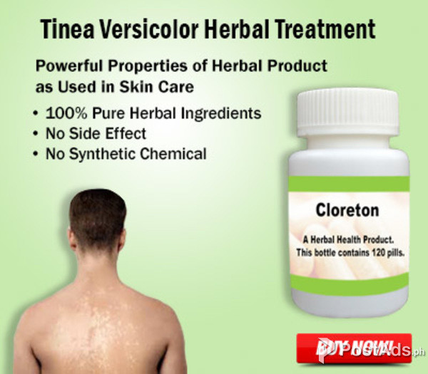 Natural Treatment for Tinea Versicolor PostAds.ph