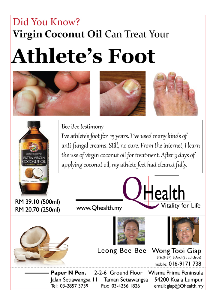 Marketing Flyer Design to Boost New Customer Acquisition Using Virgin Coconut Oil To Treat Athlete Foot. Image size:720x1017px