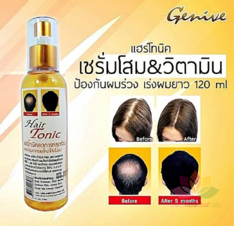 Chai xit kích mọc tóc Genive Hair Tonic ảnh 6