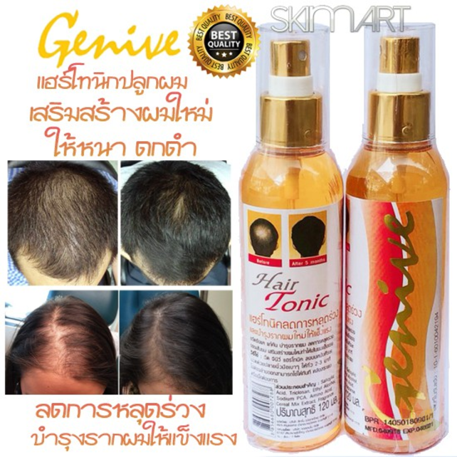 Chai xit kích mọc tóc Genive Hair Tonic ảnh 2