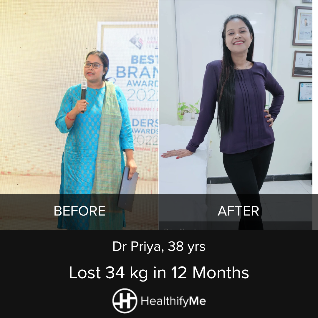 −34 kg in 1 year