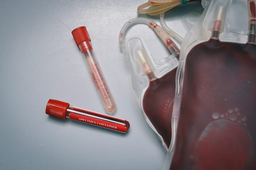 blood type coronavirus study