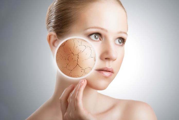 Home-Remedies-For-Dry-Skin Home Remedies for Dry Skin