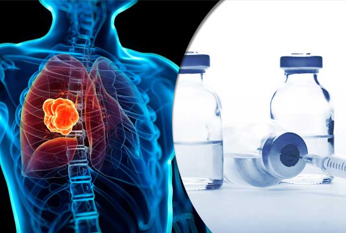 Lung-Cancer-and-Its-Most-Common-Drug-List Lung Cancer and Its Most Common Drug List